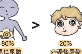 大量摄入蛋白质，真的好吗？尿酸的形成和演化图片