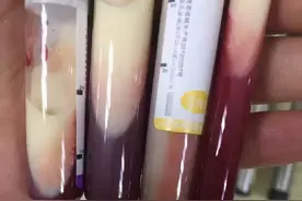 抽血白如奶，赶快告诉身边的人，这很危险图片