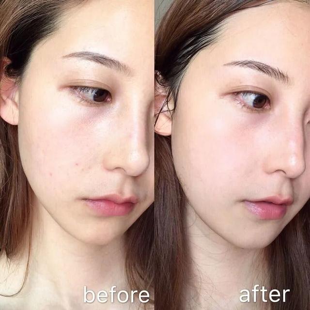 涂完芦荟胶还可以涂身体乳吗