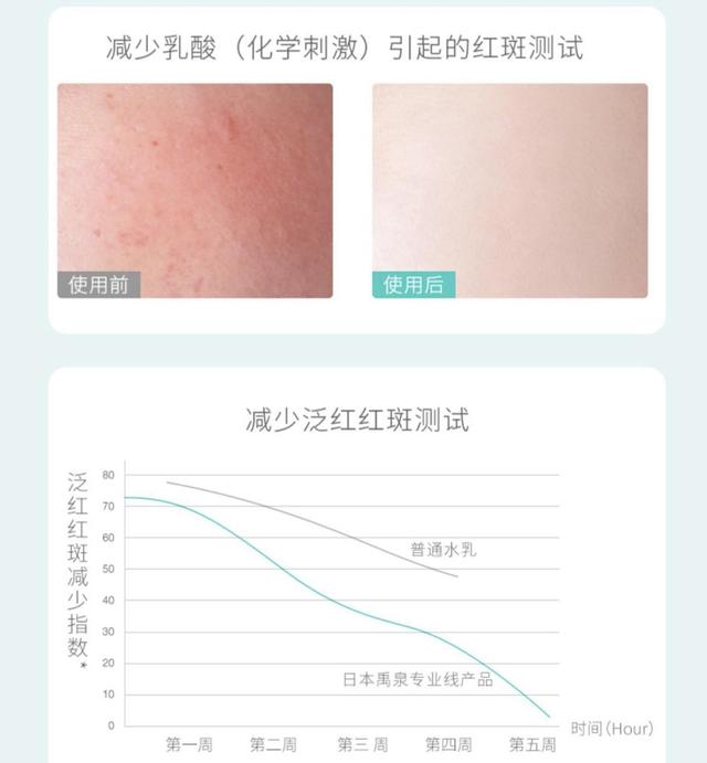 拒绝智商税！氨基酸洗面奶不应该被神话，今天我们就来扒一扒