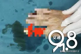 突发！杭州一女子断指求助，危急时刻他们出手了图片