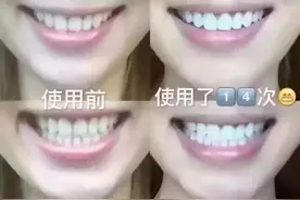 牙齿太黄不敢张嘴？神奇的洁牙片嚼着用，比用牙膏还干净图片
