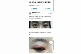 “你被蚊子咬过最无语的地方是哪里？”评论笑的肚子疼！图片