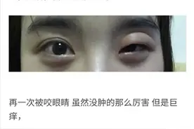 “你被蚊子咬过最无语的地方是哪里？”评论笑的肚子疼！图片