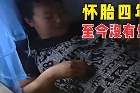 大妈怀胎四年还不生，肚子里的孩子甚至能听懂人话，医生解开谜团图片