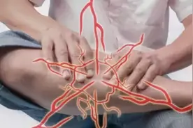 晚上睡觉小腿忽然抽筋，到底是怎么一回事儿？图片