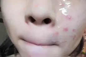 芦荟胶的正确用法：不是“直接”涂！方法弄错了，难怪会没有效果图片