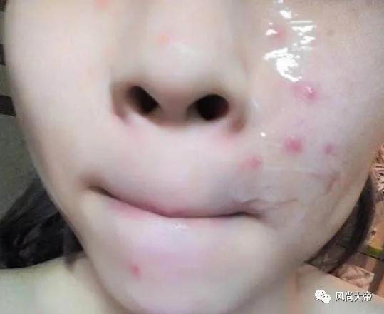 芦荟胶的正确用法:不是“直接”涂!方法弄错了,难怪会没有效果