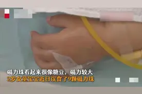 2岁女童误吞9颗磁力珠，家长盲目自救酿大错，害苦宝宝图片