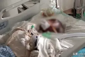 13岁女孩模仿网红做爆米花，引发爆炸离世！父亲要起诉平台图片