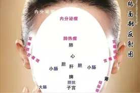 痤疮两年余，反反反复，中药半月余，焕新颜。图片