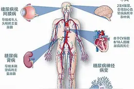 谈谈心内科大夫最害怕的疾病——糖尿病图片