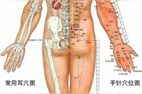针灸真的可以治病吗？图片