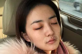 女生的唇毛（小胡子）能刮吗？图片