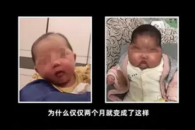 又出现“大头娃娃”了！快自查你家宝宝有没有用害人激素面霜图片