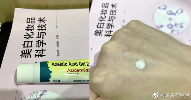 毛周角化完美芦荟胶 毛周角化完美芦荟胶