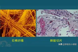 一级致癌物“石棉”，潜伏期可达10年，你用过的这些物品都有图片