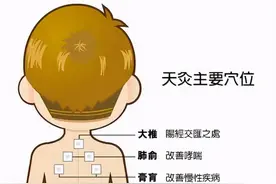 “冬病夏治”选灸疗图片