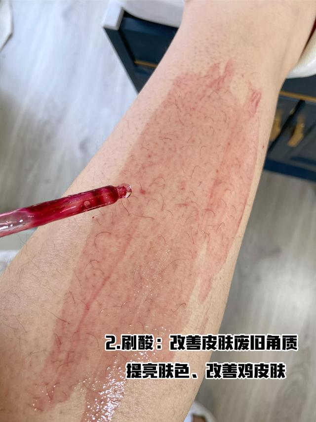 洗澡怎样去鸡皮疙瘩
