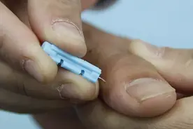 程凯养生说：口腔溃疡穴位治疗方法图片