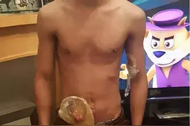 疯狂的同性生活：失去了肛门，感染了艾滋！他们的健康值得关注图片
