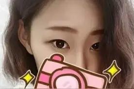 双眼皮术后两个月，现在基本都恢复好了，非常自然，靓爆啦图片