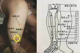 董氏奇穴 万能的刺血区和万能针灸穴组图片