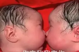龙凤胎兄妹出生后一直“亲吻”，护士都没法分开，网友：很暖心图片