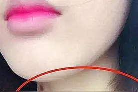13岁女生脖子被种“草莓”，真相让妈妈落泪：都是妈妈的错图片