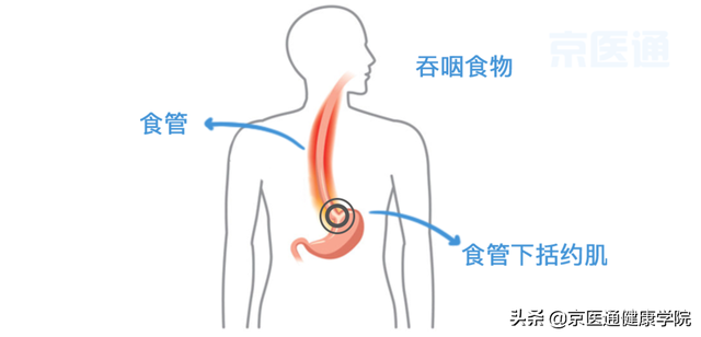 烧心是怎么回事？医生教你6个方法缓解