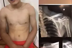 羡慕体坛球星高薪？背后的辛酸你想象不到！武磊肩膀错位带伤上场图片