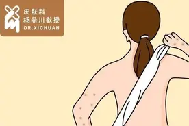皮肤长了小肉粒，竟是HPV感染？甚至会癌变图片