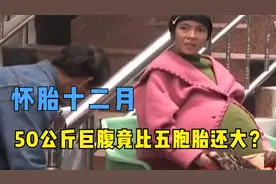 女子怀胎十二月，50公斤巨腹比五胞胎还要大，却迟迟未能生产图片