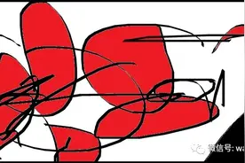 今天的漏斗胸二次手术：Wang手术+NUSS手术图片