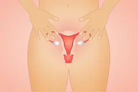 HPV感染有哪些危险因素？我们该如何预防？图片