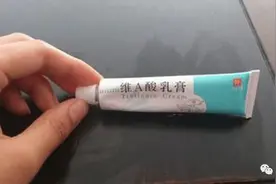 白白嫩嫩，不管男女：在药店见这“乳膏”一定要拿下图片