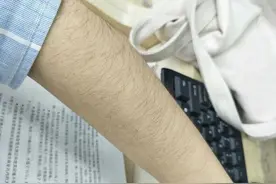 不想"毛手毛脚"？那这些脱毛方法你得知道图片