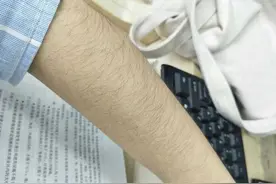 不想"毛手毛脚"？那这些脱毛方法你得知道图片