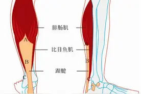 小腿疼痛的原因和治疗原则图片