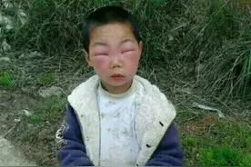 搞笑GIF：孩子，你是不是到捅马蜂窝呀？眼睛被蜇肿成这样图片
