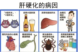 不可小觑的肝硬化，你知道吗？图片