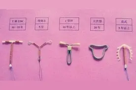 首批“上环”避孕的女人，现在怎样了？过来人哭诉：副作用太遭罪图片