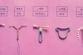 首批“上环”避孕的女人，现在怎样了？过来人哭诉：副作用太遭罪图片