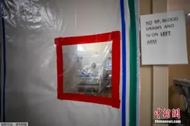 美国研究：新冠后遗症不分轻重症，无症状者也可能终身后遗症图片