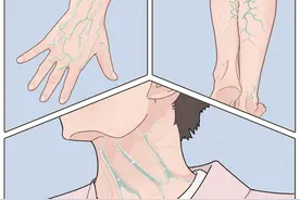 身上4个部位的青筋凸起，或是身体在“报警”，及时检查图片