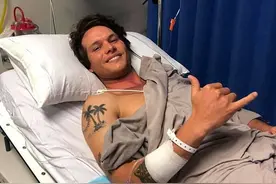 澳男子遇大白鲨，眼疾手快用冲浪板卡住鲨嘴，惊险逃命仍留骇人伤口（图）图片