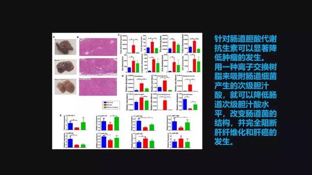 贾伟：肝病肠治？且看肠道细菌如何对肝病推波助澜