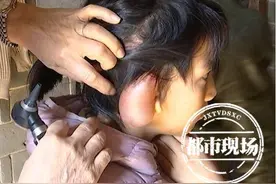 9岁女孩右耳残疾孤僻自卑 抱养家庭倾其所有：哪怕苦点也要治图片