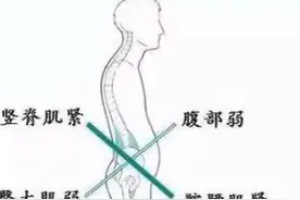 解决腰痛最简单有效的方法图片