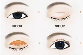 长治医学院附属和平医院：眼整形的秘密图片